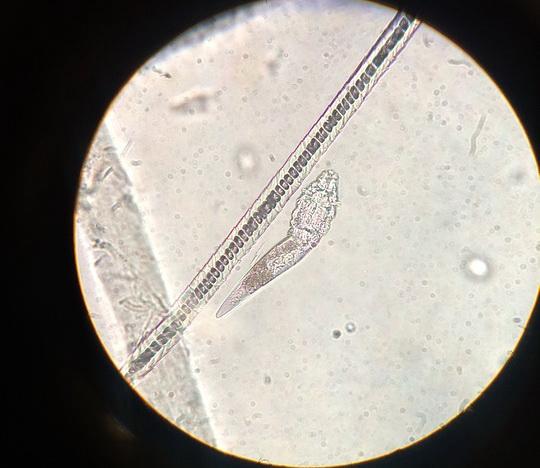 клещ демодекос по микроскопом